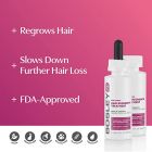 BOS Women's Regrowth T'ment 2% - Dropper 60ml